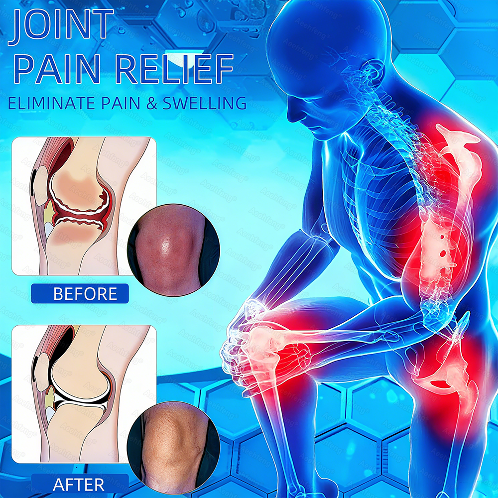 𝐀𝐞𝐞𝙝𝙛𝗲𝗻𝗴® 🌈🌈BPC-157 Joint Healing Cream🦴Treats Arthritis, Neuropathy, Rheumatism, Sports Injuries & More 🤍