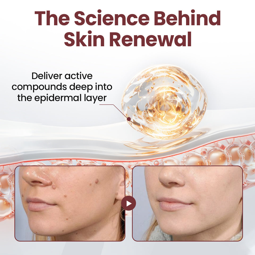 Aeehfeng® 🌿🔥 Only 5 boxes left! Today only—30% off! ✅ Clinically proven to restore smooth, clear, and even skin. Achieve lasting relief with just 4-6 boxes. ⏳ Limited stock—act fast!