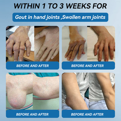 𝐀𝐞𝐞𝙝𝙛𝗲𝗻𝗴® 🌈🌈BPC-157 Joint Healing Cream🦴Treats Arthritis, Neuropathy, Rheumatism, Sports Injuries & More 🤍