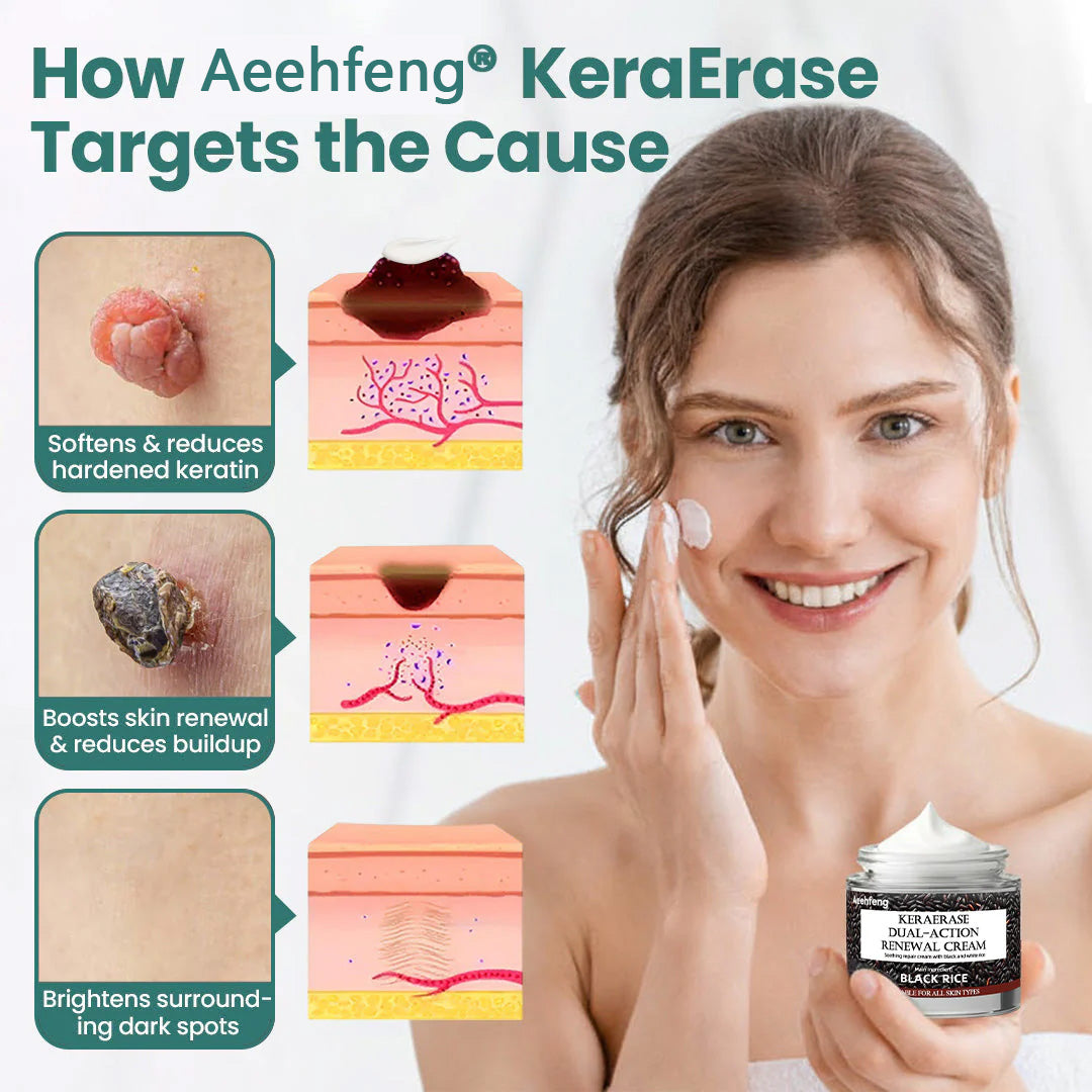 Aeehfeng® 🌿🔥 Only 5 boxes left! Today only—30% off! ✅ Clinically proven to restore smooth, clear, and even skin. Achieve lasting relief with just 4-6 boxes. ⏳ Limited stock—act fast!
